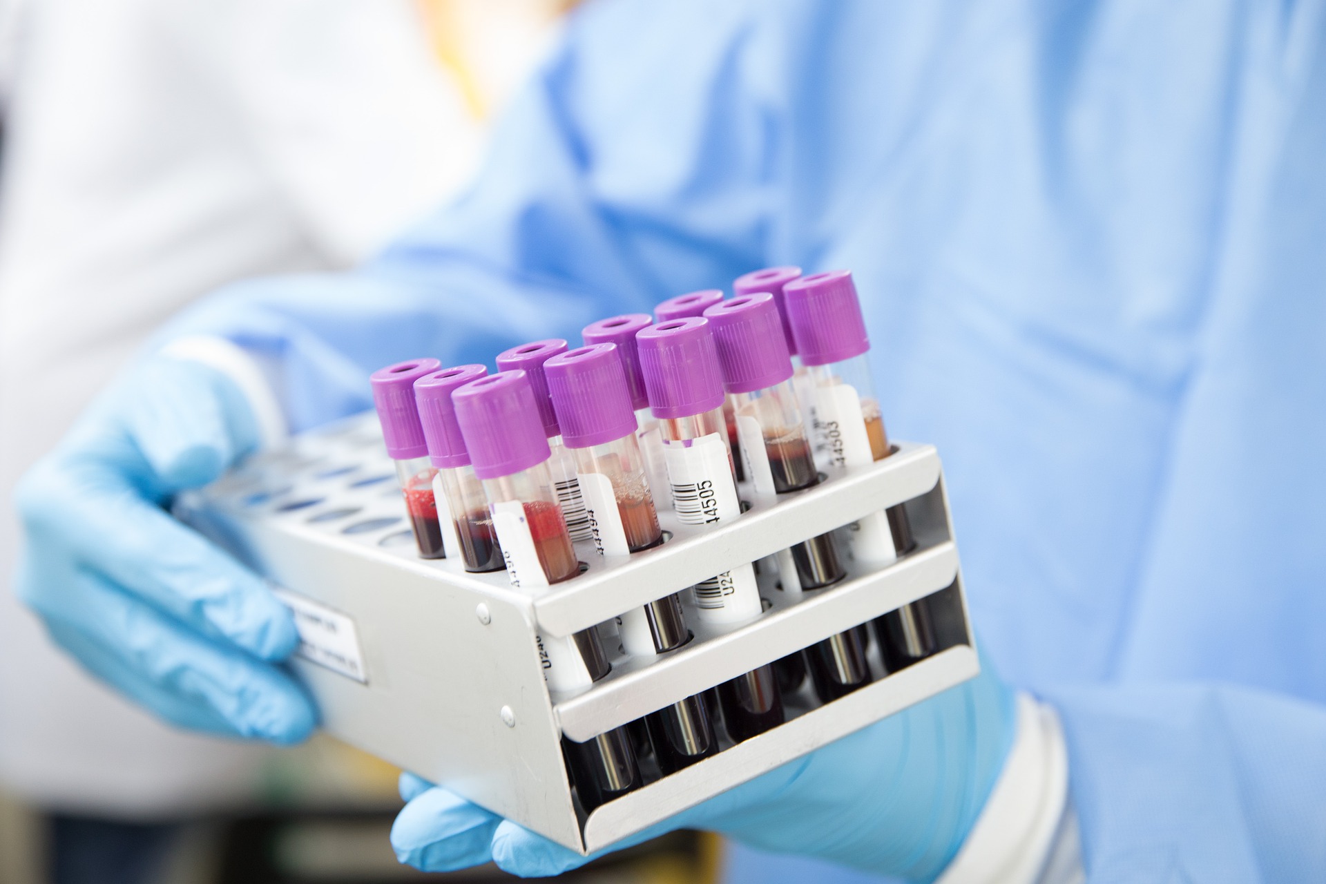 e3arabi - إي عربي – اختبار البورفيرين - Porphyrin Test